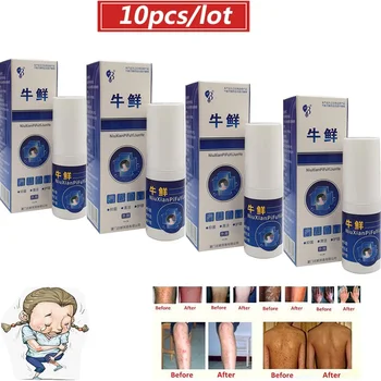 10pcs/daudz Ķīniešu ārstniecības augu Psoriasi spray Palīdzības Ādas Probelm Ziede Psoriasi Eczma spray medicīnas Ādu Neērti Produktu
